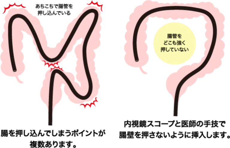 当院の大腸内視鏡検査の特徴