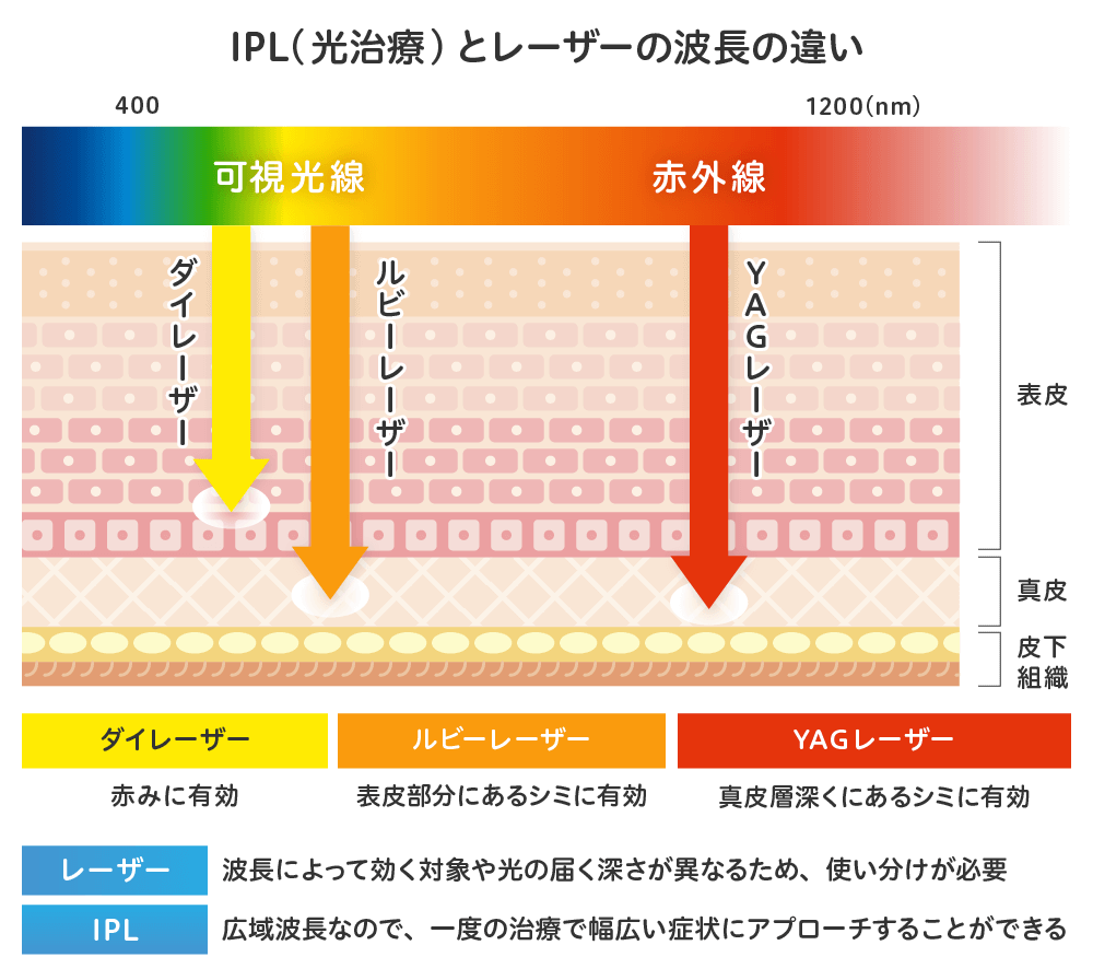 流山市の南流山内視鏡おなかクリニックノーリス（IPL光治療）でシミ取り後のイメージ画像